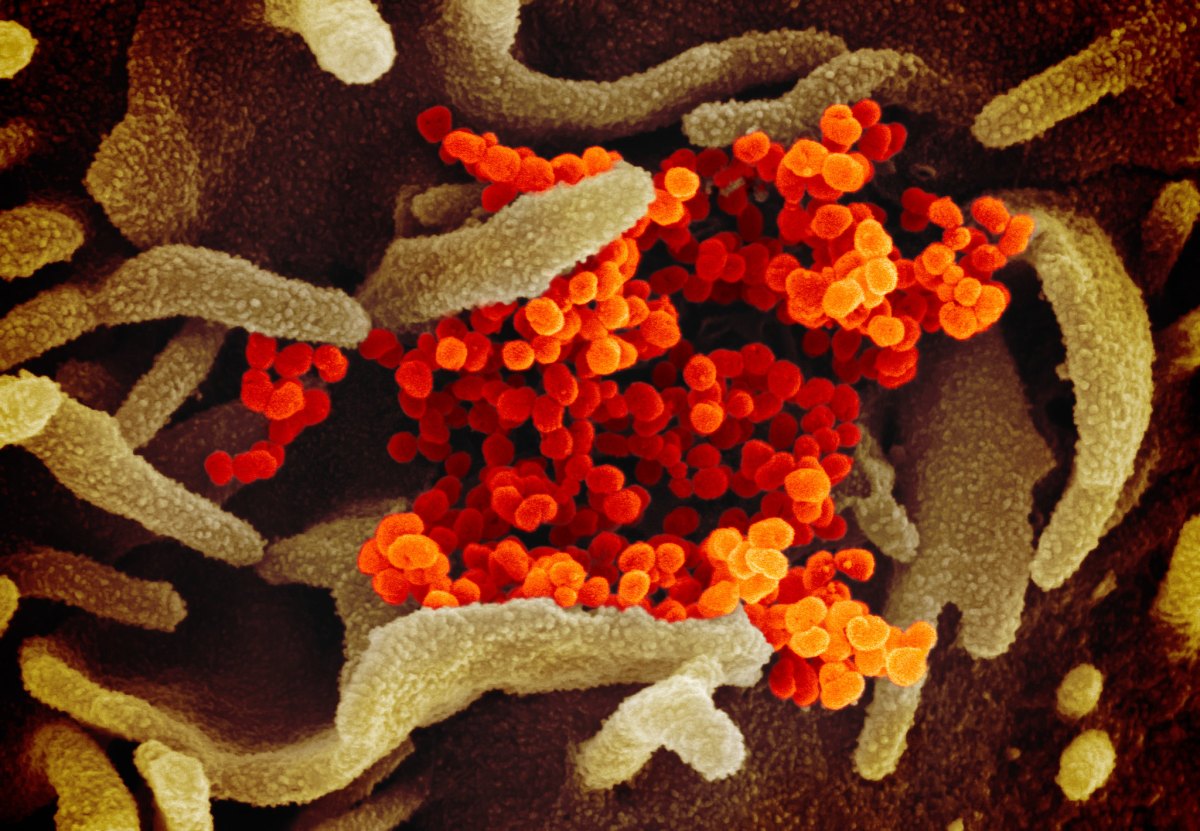 Novel Coronavirus SARS-CoV-2- ELECTRON MICROSCOPE IMAGE